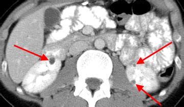 Genitourinary Radiology