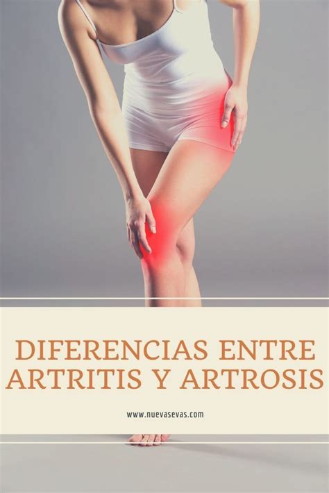 Diferencias Entre Artritis Y Artrosis Causas S Ntomas Diagn Stico