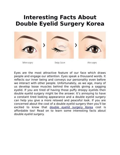 Interesting Facts About Double Eyelid Surgery Korea