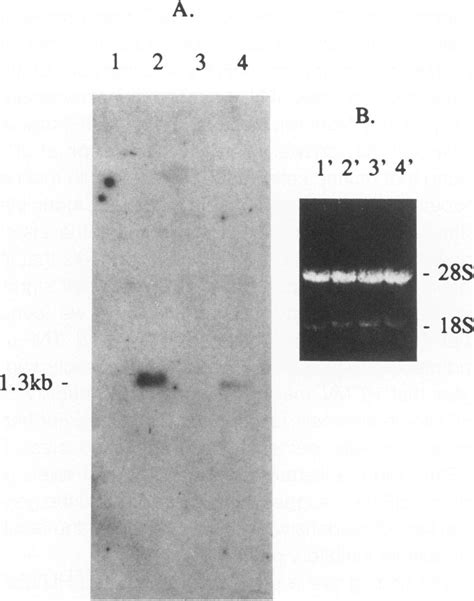 A Northern Blot Hybridization With A Random Primerlabeled 2pg Ct Cdna