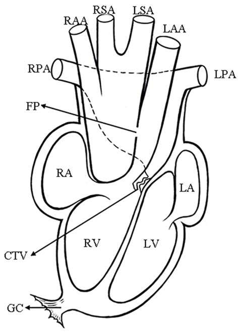 The Heart Of A Male Adult Specimen Sample 3 Alligator Sinensis In