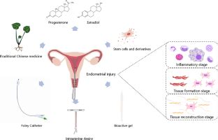 修复和再生受损子宫内膜的方法 Reproductive Sciences X MOL