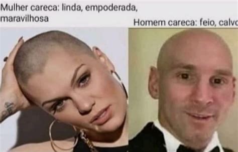 Mulher Careca Linda Empoderada Maravilhosa Homem Careca Feio Calve