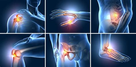 early signs  arthritis   pay attention