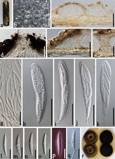 Parabambusicola Yunnanensis Facesoffungi Number Fof 12952 Faces Of Fungi