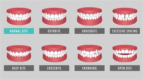 What Is Orthodontics Dr Jamilian