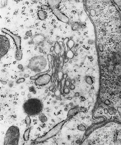 Lysosome Electron Micrograph