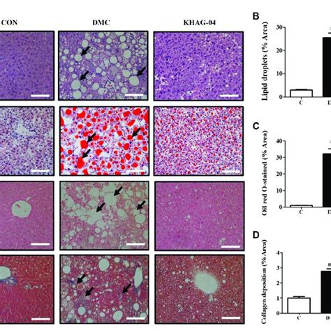 Effects Of Khag 04 On Hepatic Steatosis In The Liver Of Hfd And