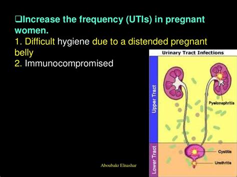 Urinary Tract Infections During Pregnancy