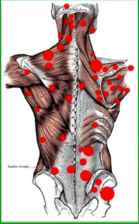 Trigger Point Therapy Sri Kadir Clinic