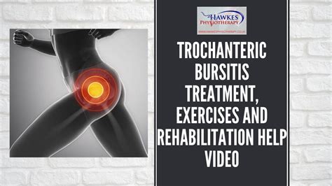 Trochanteric bursitis treatment, exercises and rehabilitation help video