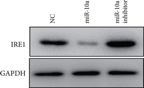 Ire Is The Target Gene Of Mir A In Cardiomyocytes A Schematic