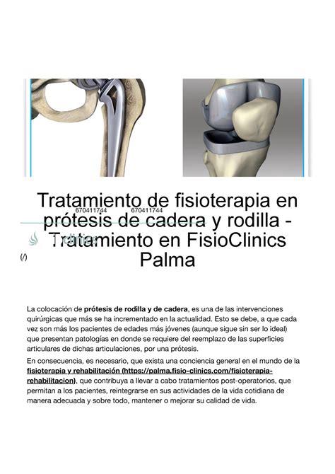 Tratamiento De Fisioterapia En Pr Tesis De Cadera Y Rodilla