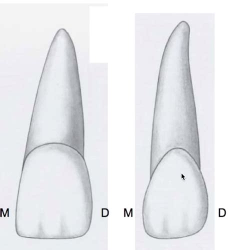 Permanent Maxillary Lateral Incisors Flashcards Quizlet