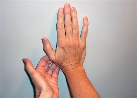 Stretching The Transverse Carpal Ligament