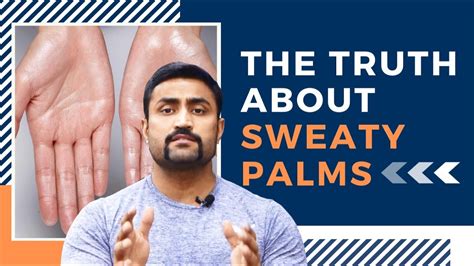 Sweaty Palms Why How To Treat Them Youtube