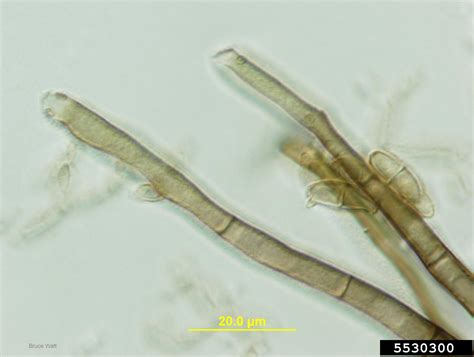 Cladosporium Fungi Genus Cladosporium