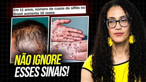 Mulheres Com Sífilis - Sifilis Primaria Feminina Biolab | A Sífilis é Uma Infecção