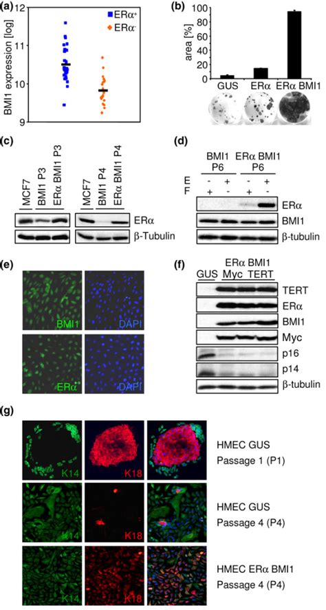 Expression of oestrogen receptor alpha ERα and BMI1 in human mammary