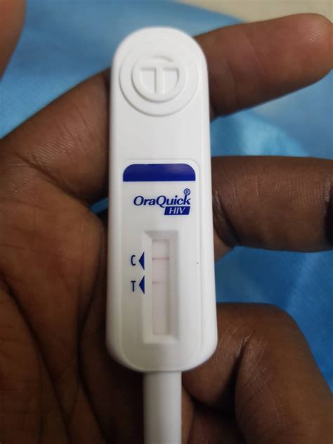 False Positive Hiv Test Images at Paul Morrison blog