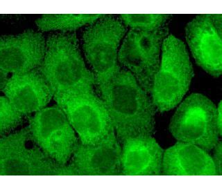 Anti PFKP Antibody F 7 SCBT Santa Cruz Biotechnology