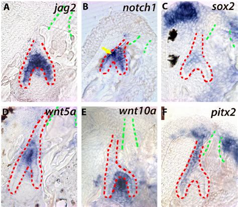 Expression Of Genes From The Notch Ac And Wnt Pathways Df During