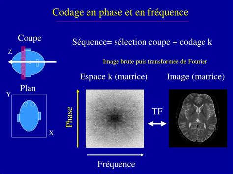 Ppt Base Physique Irm S Quences Echo De Spin Et Echo De