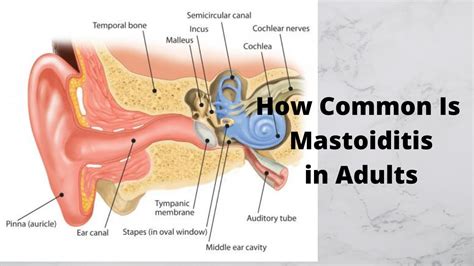 How Common Is Mastoiditis In Adults Youtube