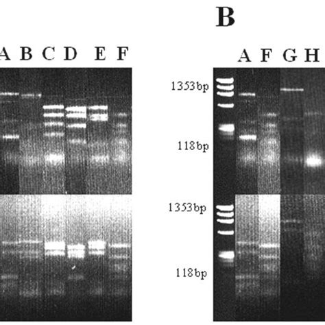 Rflp Pro Fi Les Of 16s Rrna Gene Fragments Ampli Fi Ed From Download Scientific Diagram