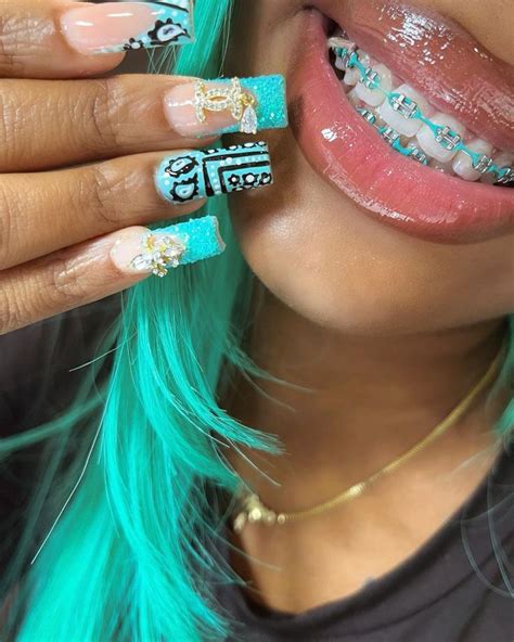 Pin By ℳ On Nails Braces Teeth Colors Cute Braces Colors Braces