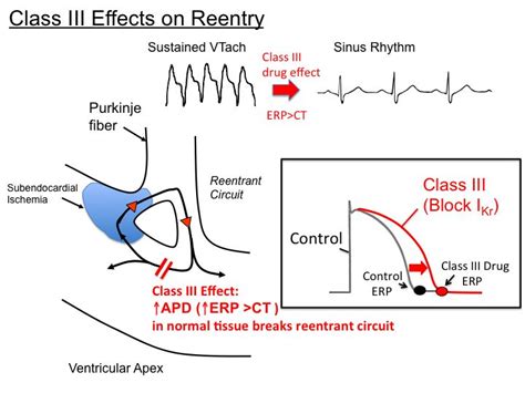 Introtoantiarrhythmics Tusom Pharmwiki Adrenergic Receptors