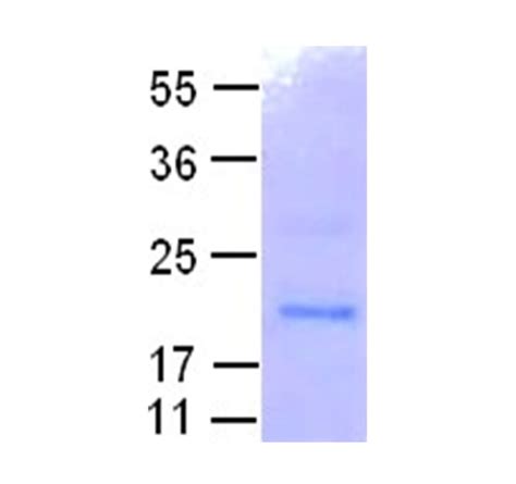 Rab11 Protein NewEast Biosciences GTPase Oncogene And Bioactive