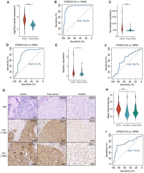 NT5DC2 Is A Novel Prognostic Marker In Human Hepatocellular Carcinoma