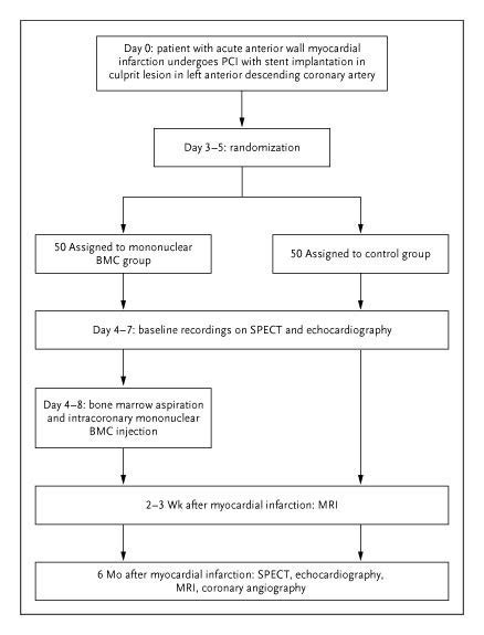 Intracoronary Injection Of Mononuclear Bone Marrow Cells In Acute