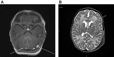 baby mri scan results - Marget Abel