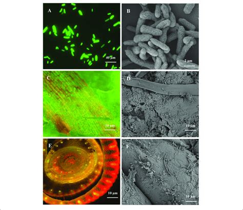 Clsm And Sem Micrographs Images Showing Morphology And Colonization