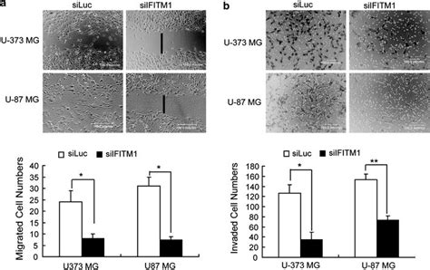 Effect Of Ifitm1 Knockdown On Glioma Cell Migration And Invasion Download Scientific Diagram