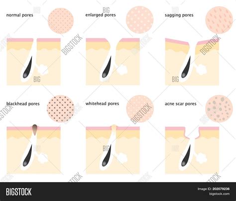 Set Skin Pores: Normal Image & Photo (Free Trial) | Bigstock