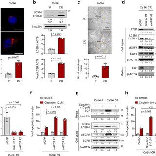 Nanog Promotes Cisplatin Resistance Through Autophagy Mediated Egfr