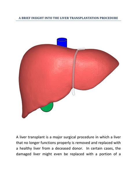 Ppt A Brief Insight Into The Liver Transplantation Procedure Powerpoint Presentation Id11243588