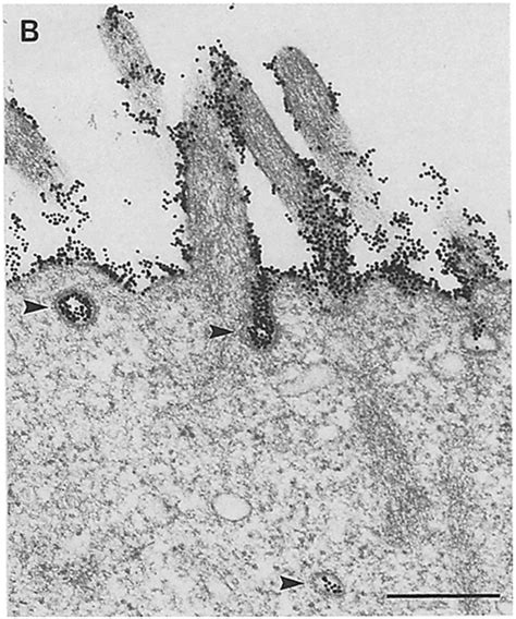 Selective Binding Of Ctb Colloidal Gold To Rabbit Peyer S Patch M