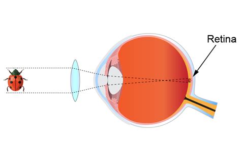 Convex Lens Use Glasses