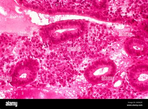 Light Micrograph Of A Section Of The Endometrium The Mucosal Lining Of