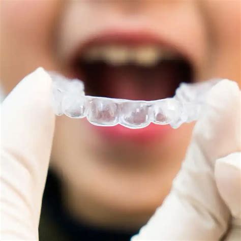 Teeth Alignment Calgary Invisalign Braces Impact Orthodontics