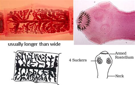 Cestodes Pseudophyllidea And Cyclophyllidea Flashcards Quizlet