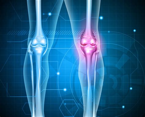 patients report zimmer persona knee implant complications top class