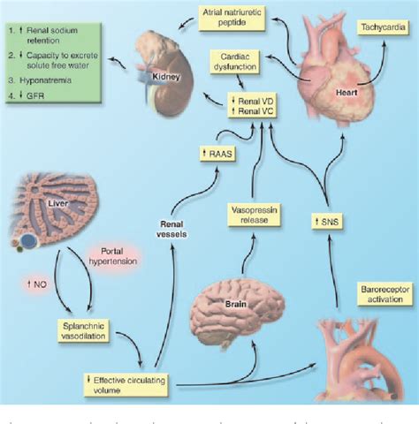 [pdf] In Depth Review Hepatorenal Syndrome Pathophysiology And