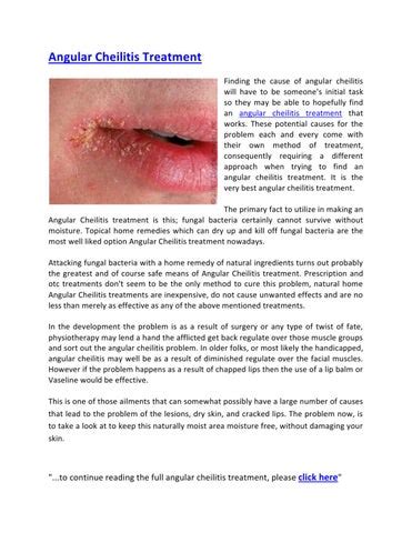 Angular Cheilitis Treatment by Raymond CC - Issuu