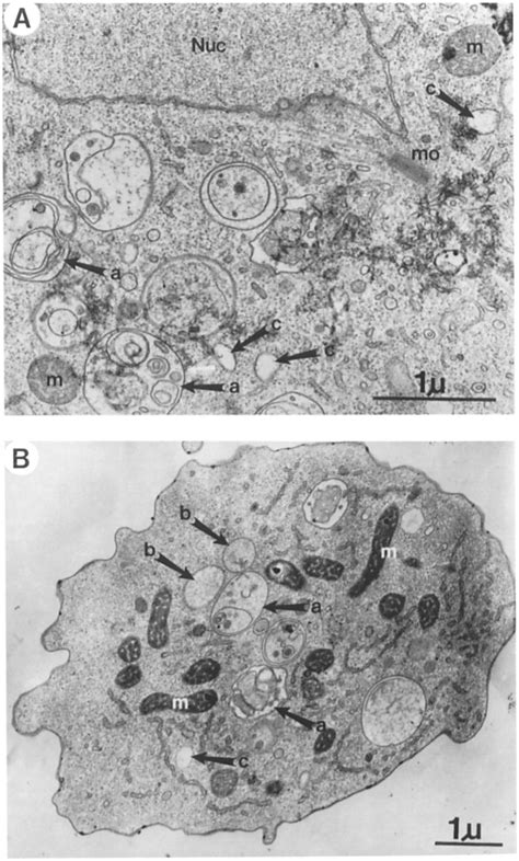 Transmission Electron Micrographs Demonstrating The Types Of