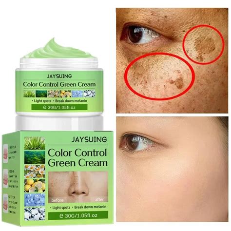 Creme Clareador De Sardas Face Remove Melasma Manchas Escuras Melanina